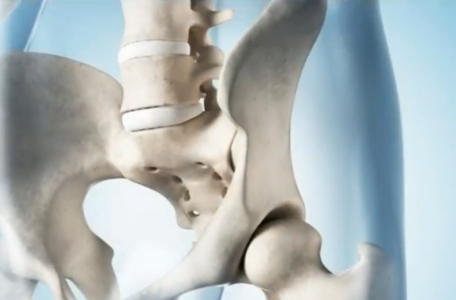 Osteoporoza   YouTube (1)