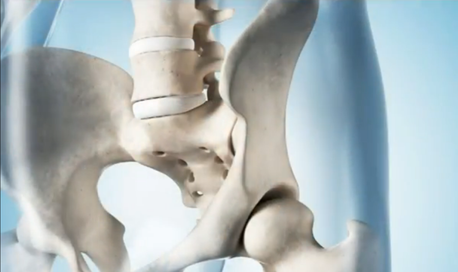 Osteoporoza   YouTube (1)